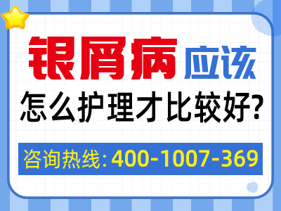 男性牛皮癣治疗过程中有哪些禁忌